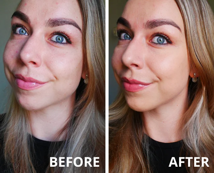 Clinique Clinical foundation resultaat