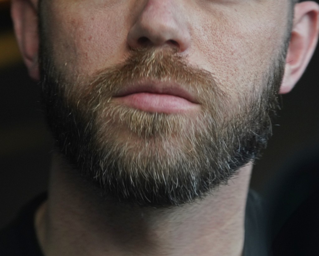 Hairlust Wonder Beard Ervaring Resultaat