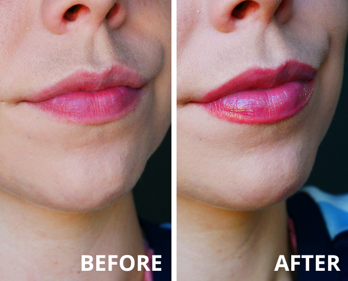 Too Faced Lip Injection Extreme result